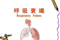 护膝英语翻译